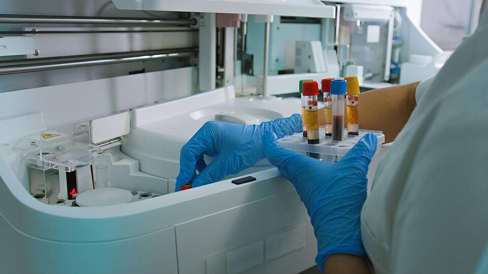 HbA1c diagnostic investigation and medical test