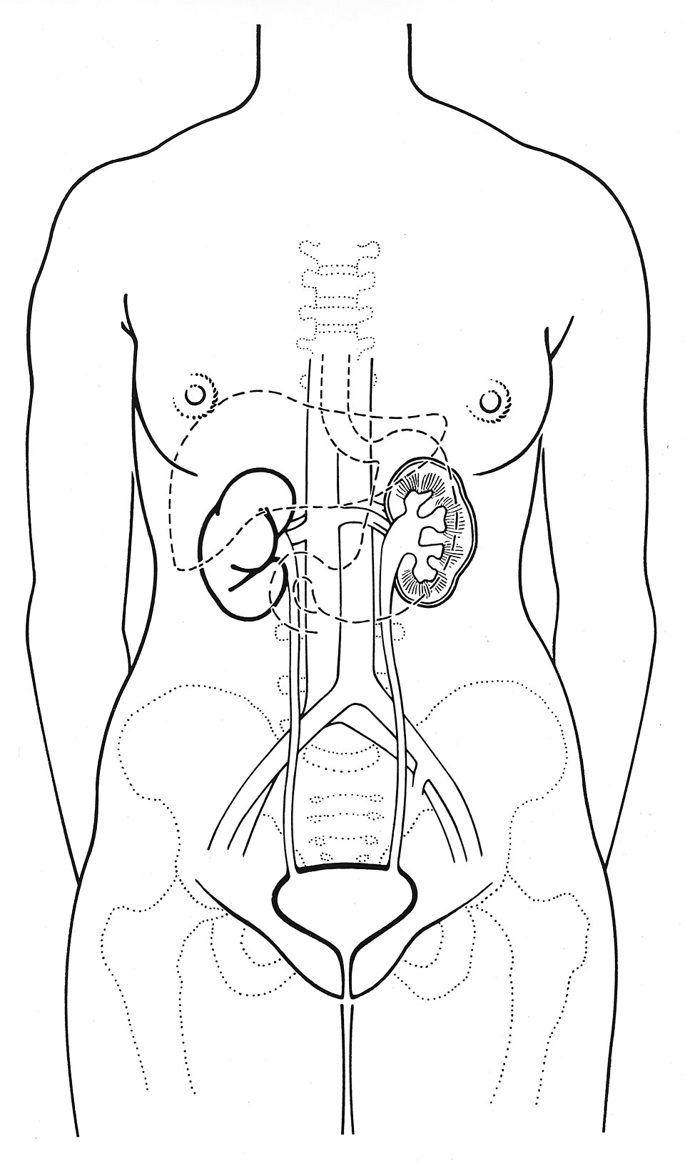 Erectile Dysfunction clinical reference photography